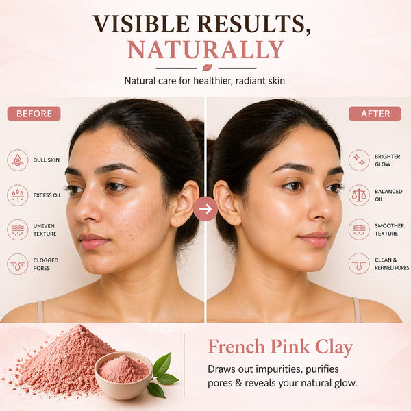 French pink